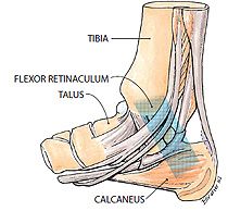 Tarsal Tunnel Syndrome - Hersco Edu Center