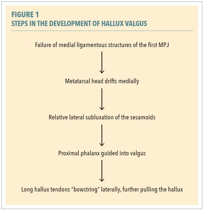 STEPS IN THE DEVELOPMENT OF HALLUX VALGUS