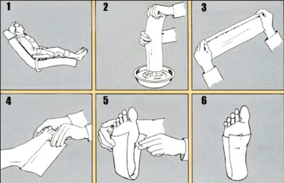 Supine position for casting