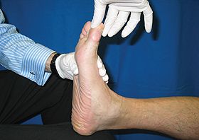 Assessing Adult Acquired Flatfoot Hersco Edu Center