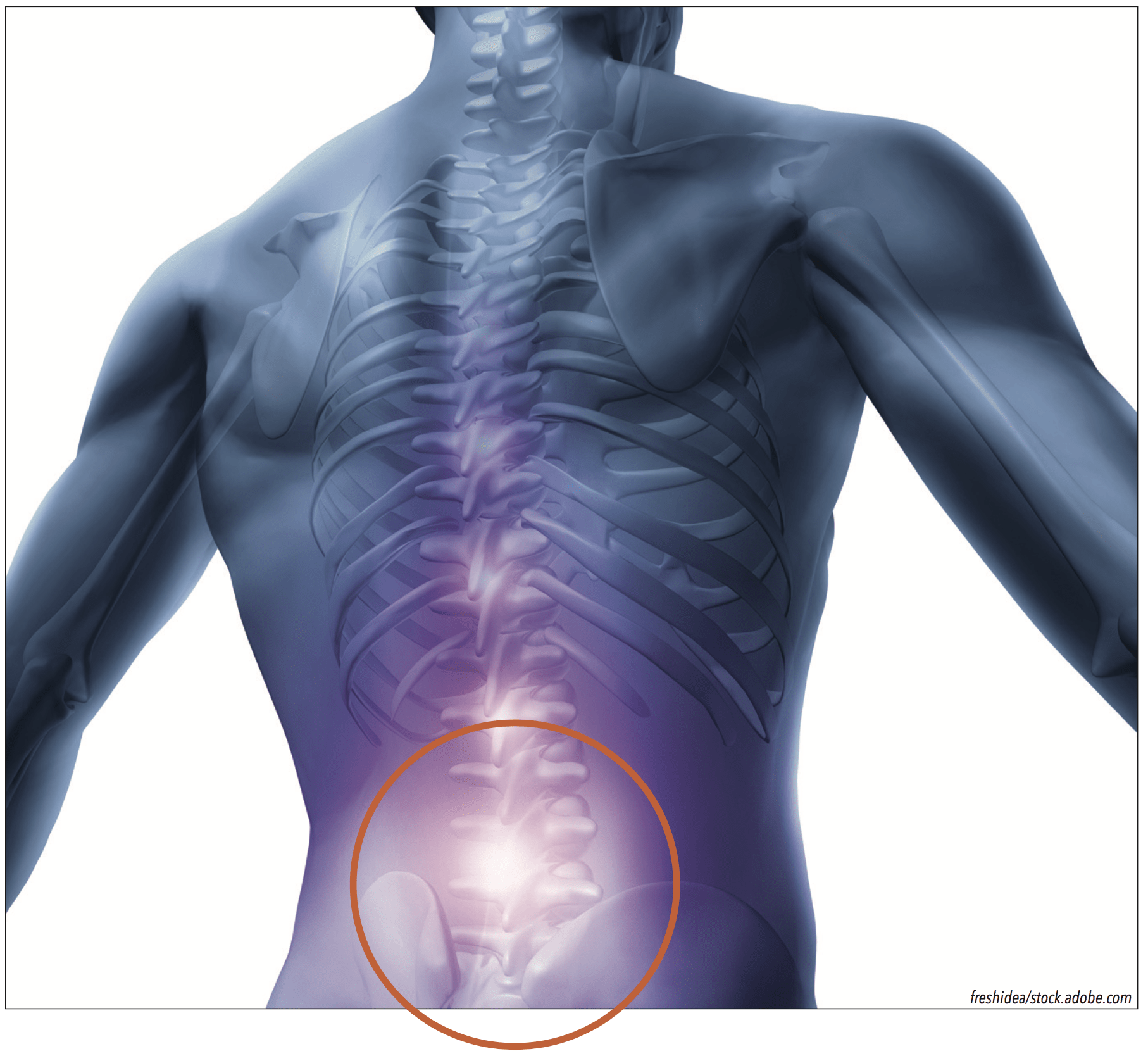 Lumbago Is Also Called Low Back Pain Or LBP Stock Photo, Picture