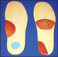 Left: Scaphoid pad and heel plug. Right: Met bar and heel wedge.